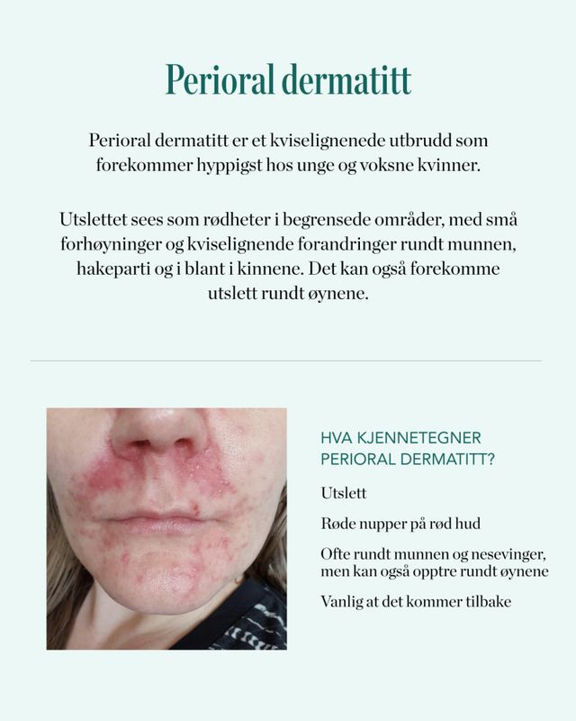 SOS paste