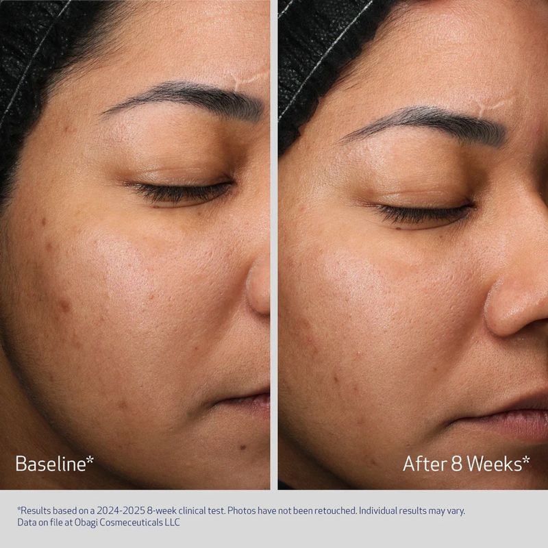 RETINOL + PHA