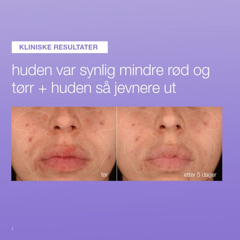 stabilizing repair serum