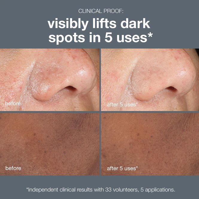 Hovedbilde powerbright dark spot peel