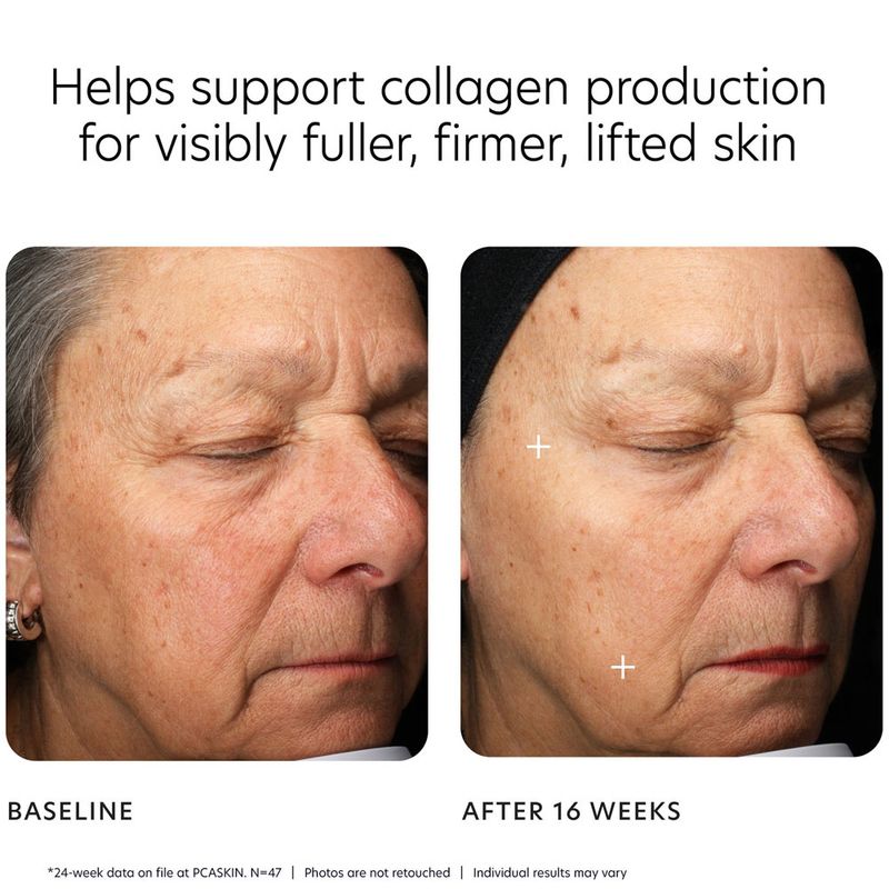 MGF Age Renewal Cream