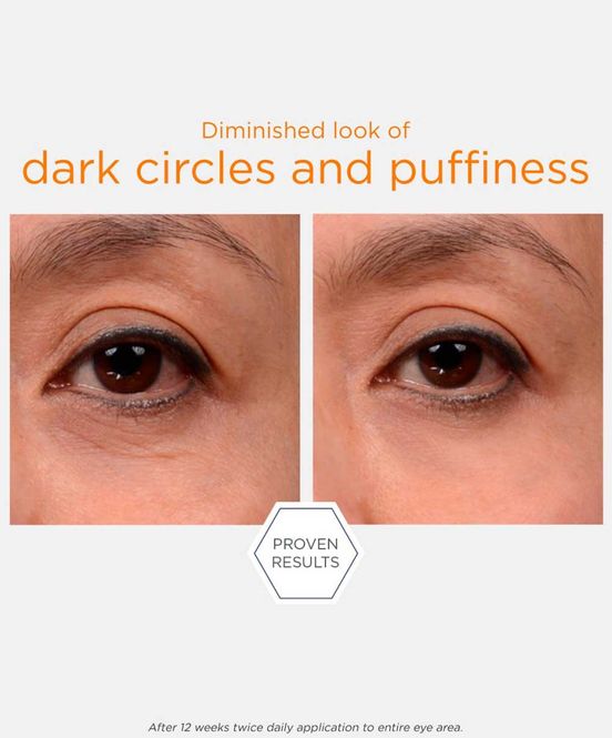 Hovedbilde Brightening Eye Cream